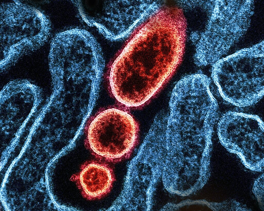 Antibodi